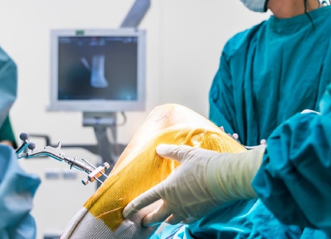  Get the Best Knee Replacement Surgeons in Adelaide