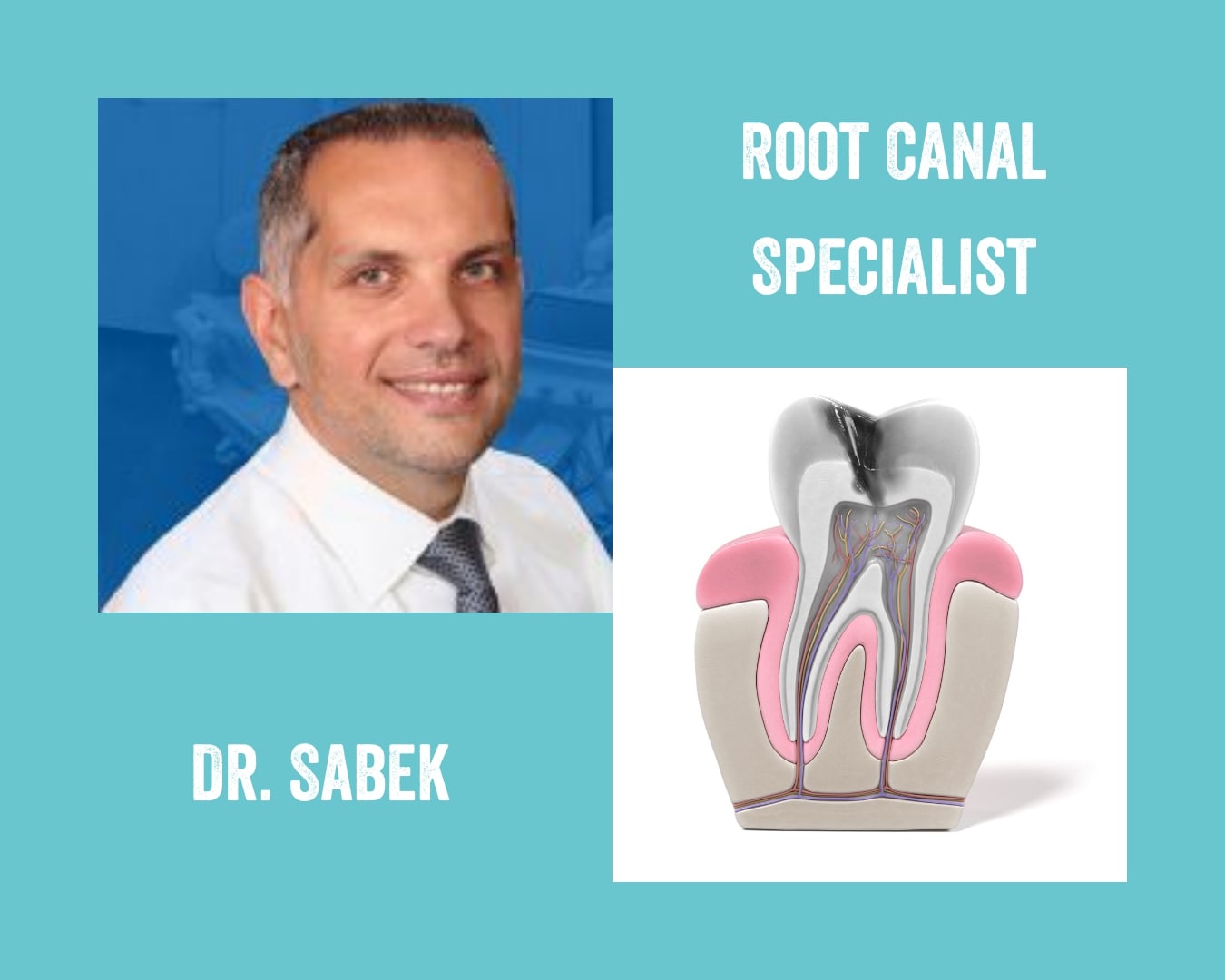  Root Canal Treatment in Chicago