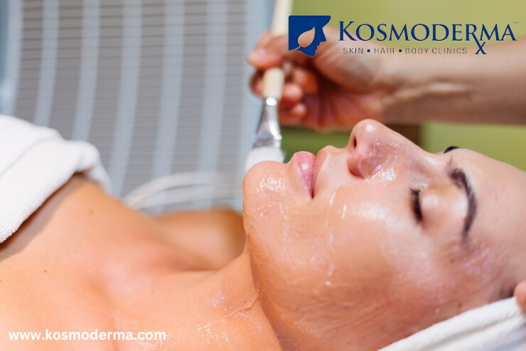  Chemical Peel for Open Pores & Acne Scars in Delhi | Expert Skin Treatments at Kosmoderma