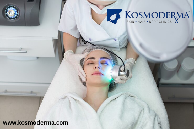  Best Laser Skin Lightening Treatment in Delhi | Achieve Glowing Skin at Kosmoderma