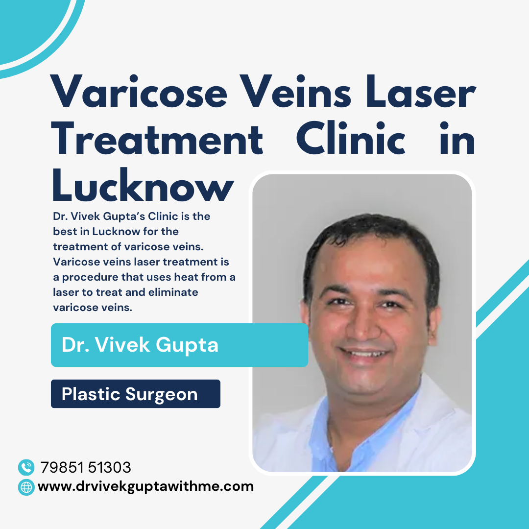  Varicose Veins Laser Treatment Clinic in Lucknow