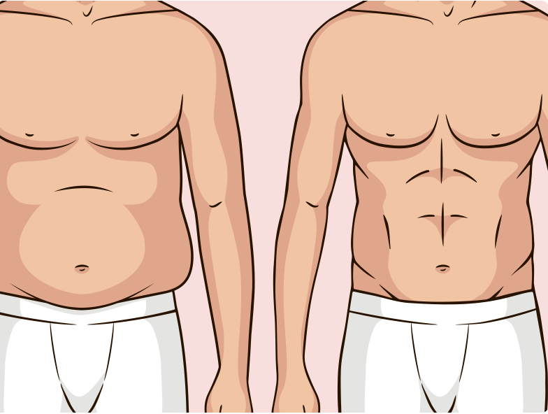  Liposuction in Lahore