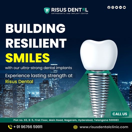  Ultra-Strong Dental Implants for Lasting Strength at Risus Dental Clinic, Nagaram, Hyderabad