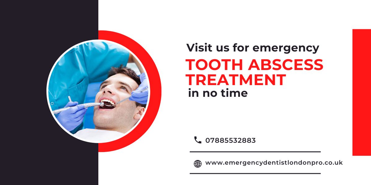  Visit us for emergency tooth abscess treatment in no time