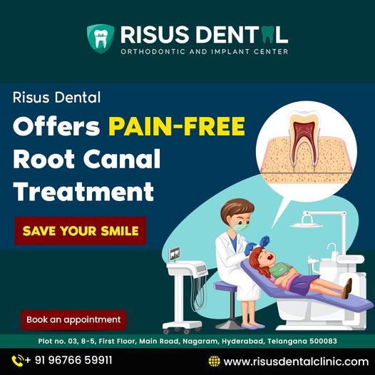  Pain-Free Root Canal Treatment at Risus Dental | Save Your Smile