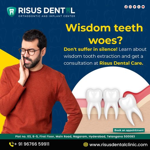  Get painless wisdom teeth extraction treatment at risus dental