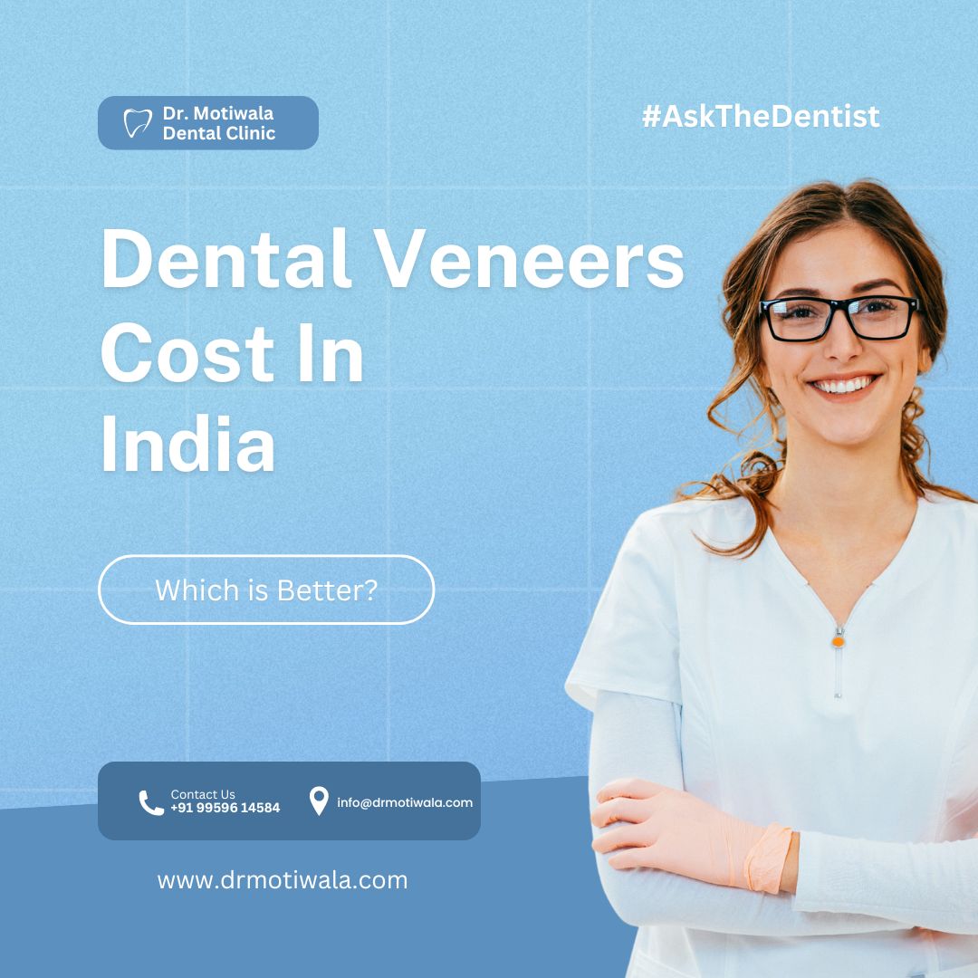  Best Dental Veneers Cost In India