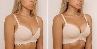  Breast Augmentation In Kakinada | Srujana Hospital