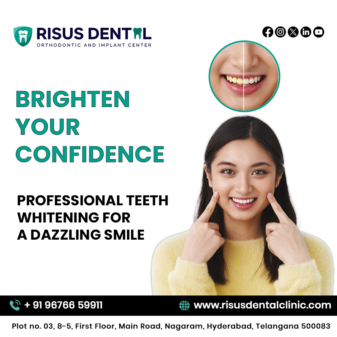  Best Teeth Whitening  at Risus Dental: Brighten Your Smile Today