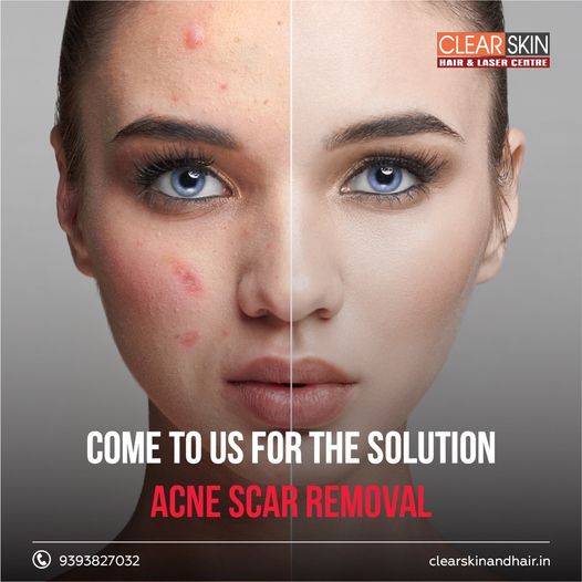  skin doctor dermatologist in kurnool