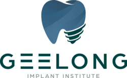  Geelong Implant Institute | Official ALL-ON-4® Centre Of Excellence