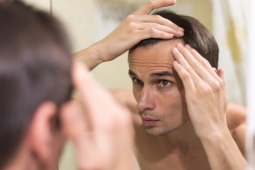  Regain Your Confidence with ISIVI Medicina's Hair Implants for Men