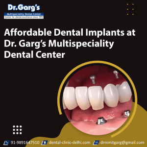  Affordable Dental Implants at Dr. Garg’s Multispeciality Dental Center