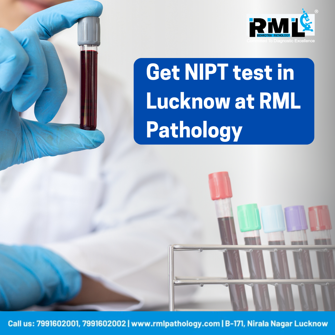  Get NIPT test in Lucknow for your baby for bright future