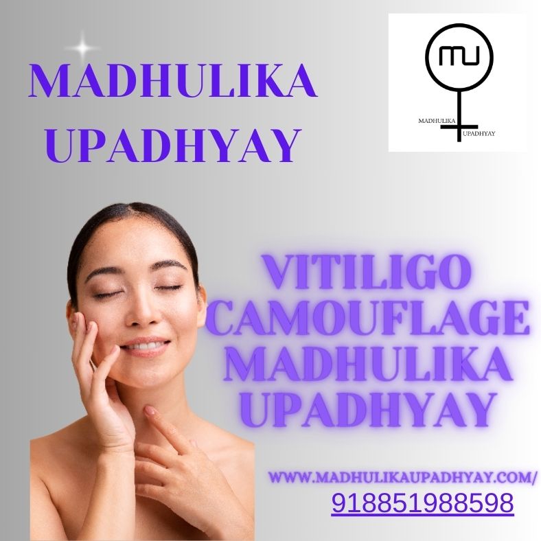  Vitiligo camouflage Madhulika Upadhyay