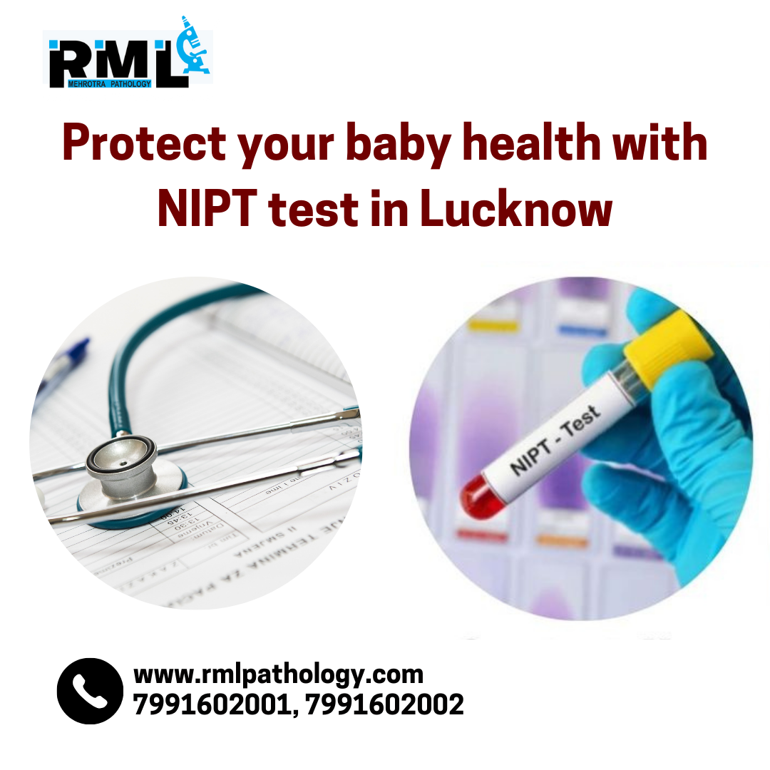  Why is NIPT test important in Lucknow ?