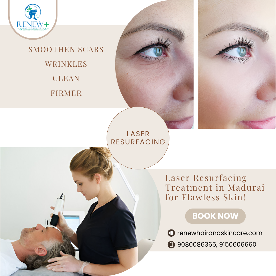  Laser Resurfacing Treatment in Madurai – Renew Hair and Skin Care