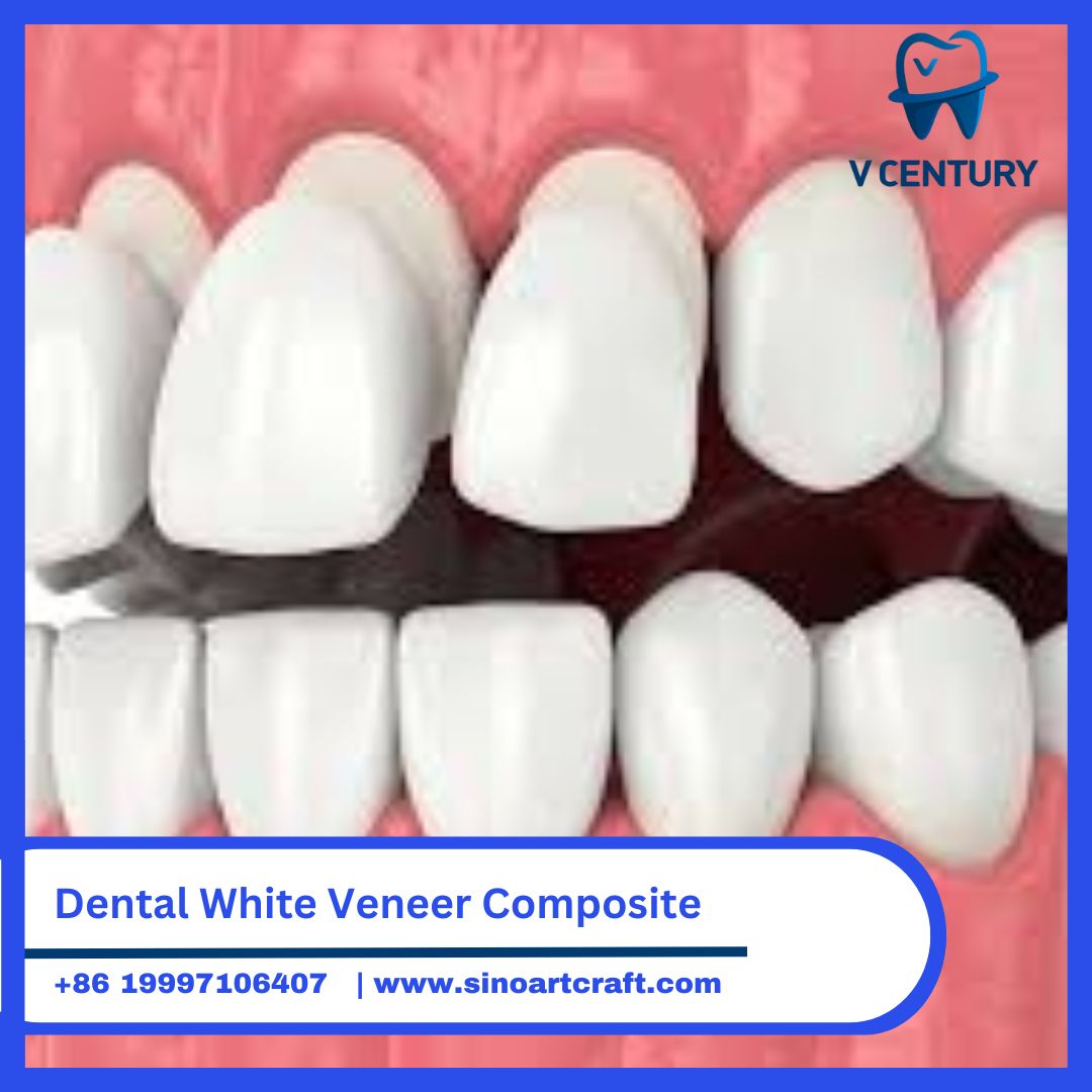  Dental White Veneer Composite