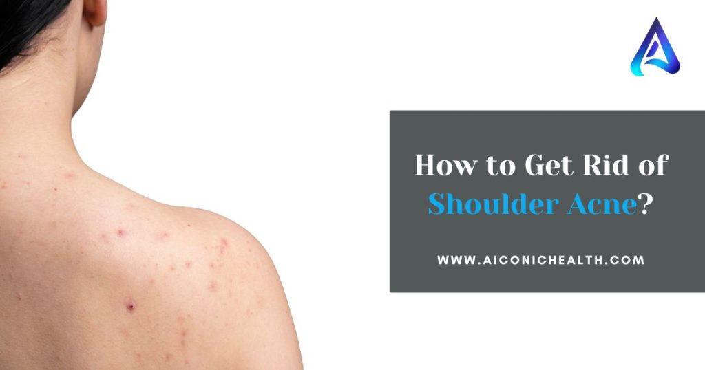  How to Get Rid of Shoulder Acne?