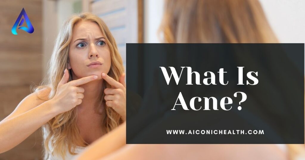  Understanding Acne: Causes and Solutions